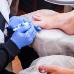 How Podiatrists Treat Common Foot Infections
