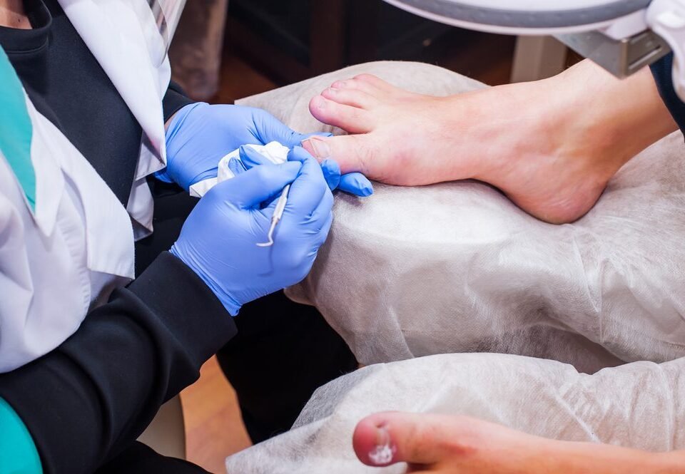 How Podiatrists Treat Common Foot Infections