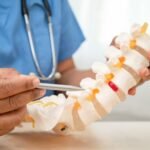 How Spinal Cord Stimulation Can Help Alleviate Chronic Pain