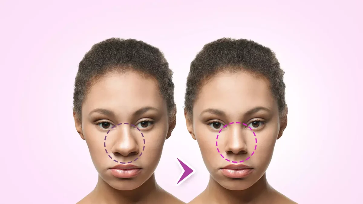 How Do I Know if I Need Plastic Surgery?