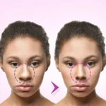 How Do I Know if I Need Plastic Surgery?
