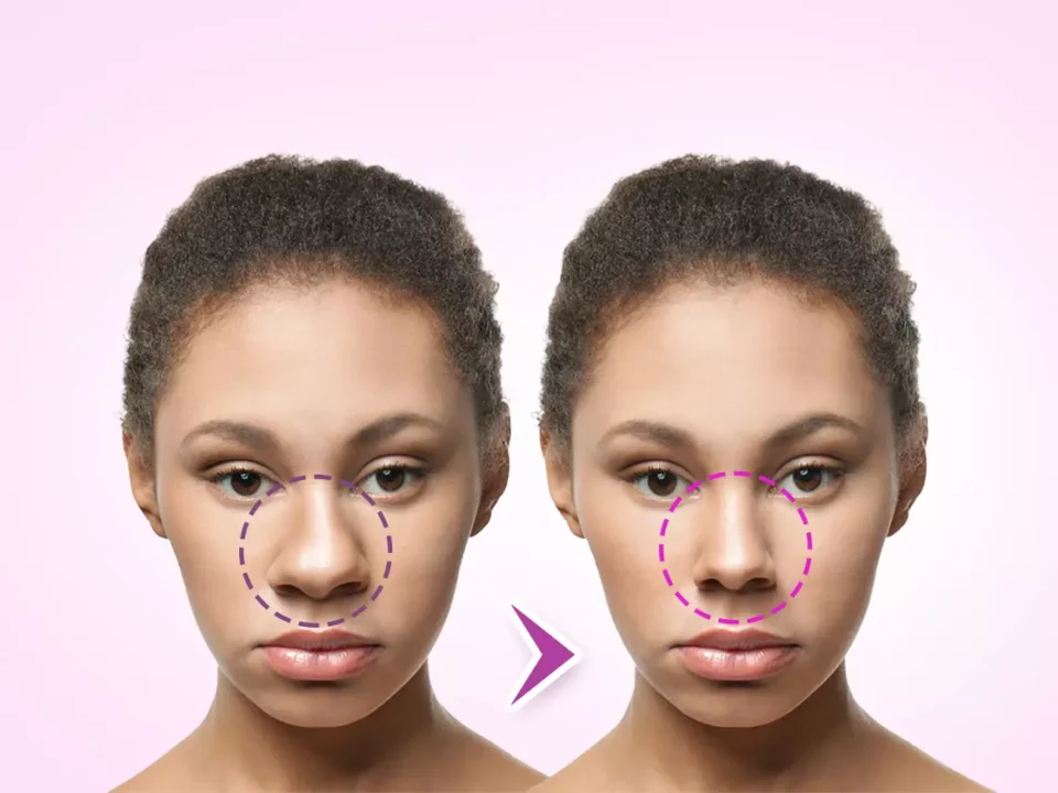 How Do I Know if I Need Plastic Surgery?