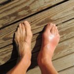 Identifying When It’s Time To Seek Help for Foot Pain