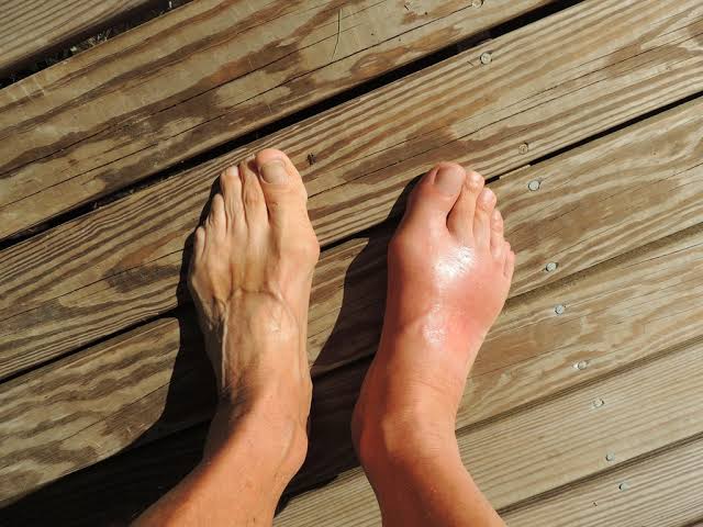 Identifying When It’s Time To Seek Help for Foot Pain