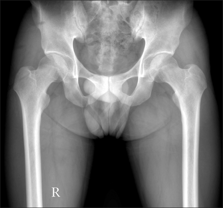 The Relationship Between Hip Pain and Age-Related Changes